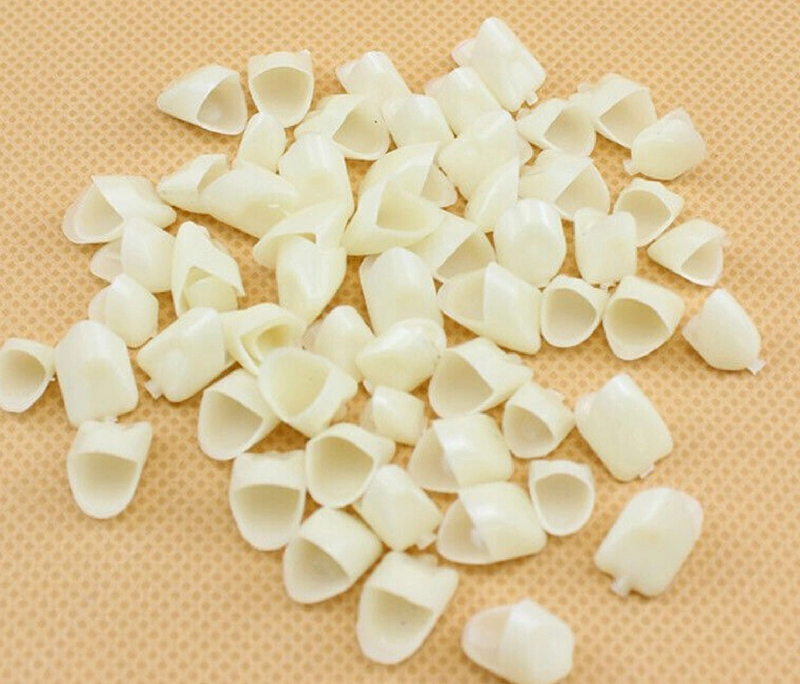 Gắn răng tạm có đau không? Những lưu ý quan trọng khi bọc răng sứ